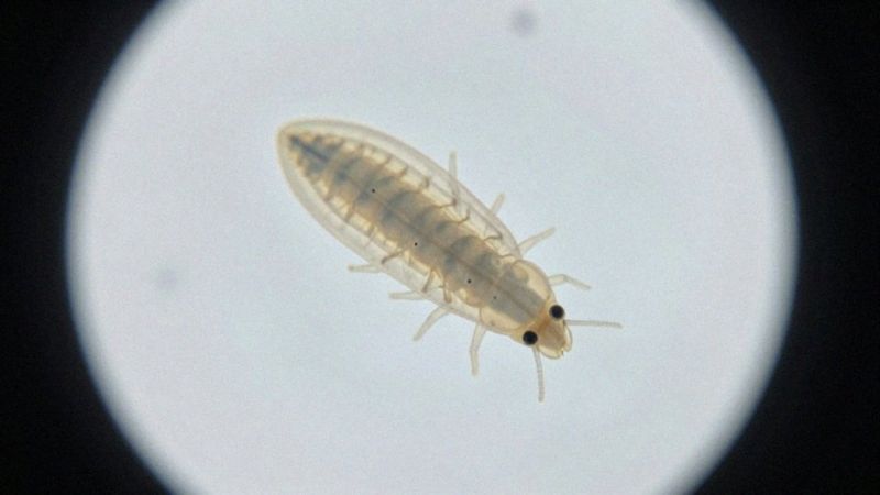 Jak wygląda pasożyt pod mikroskopem?