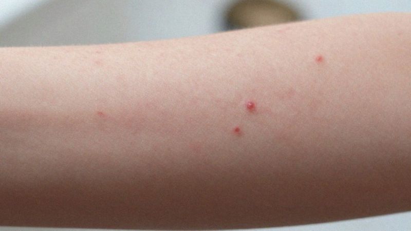 Kiedy pojawiają się objawy po wysiłku fizycznym?