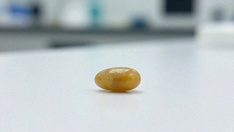 Jak kamienie żółciowe znikają samoistnie?