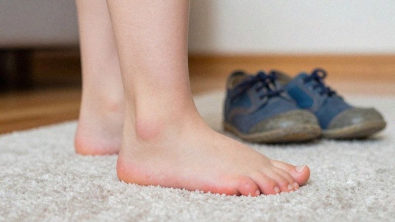 Jakie są przyczyny odcisków u dziecka?