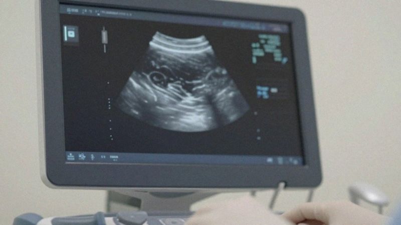Czy USG wystarcza do rozpoznania uszkodzenia ścięgien palców?