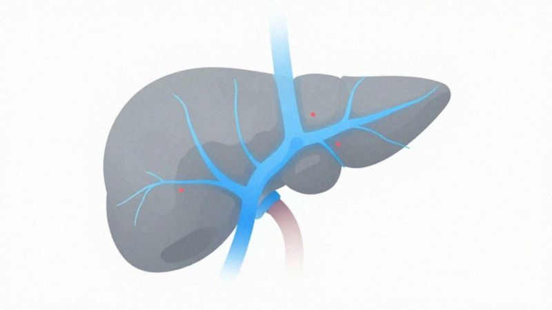 Jak autoimmunologia prowadzi do cukrzycy typu 1?