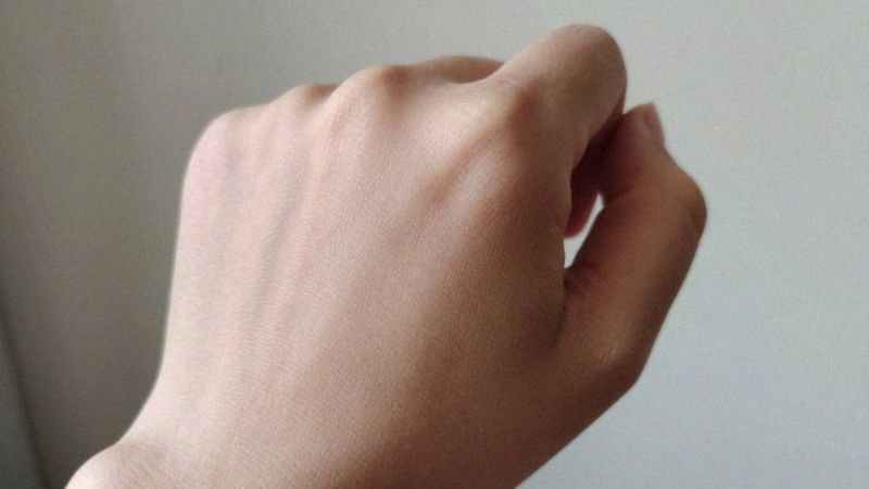Po czym rozpoznać suchą skórę?