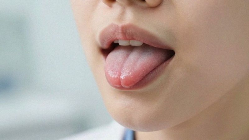 Jak niedoczynność tarczycy prowadzi do pieczenia języka?