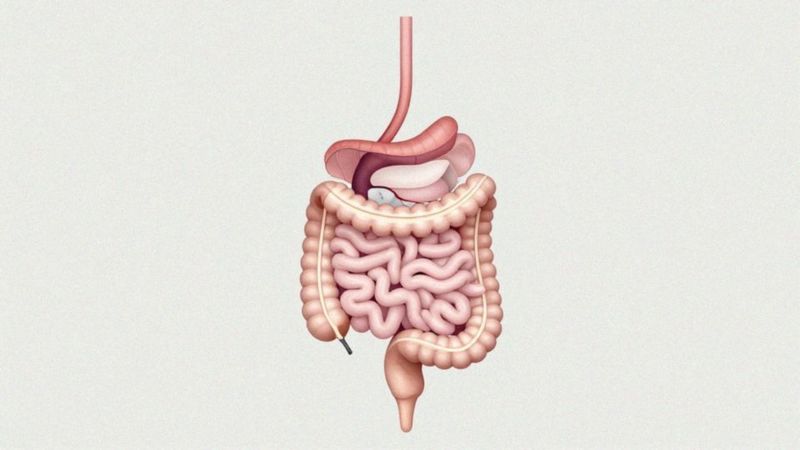 Kiedy zamknąć stomię: ileostomia czy kolostomia?