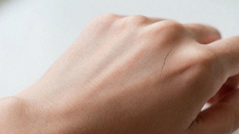 W jaki sposób defekt bariery skórnej prowadzi do AZS?