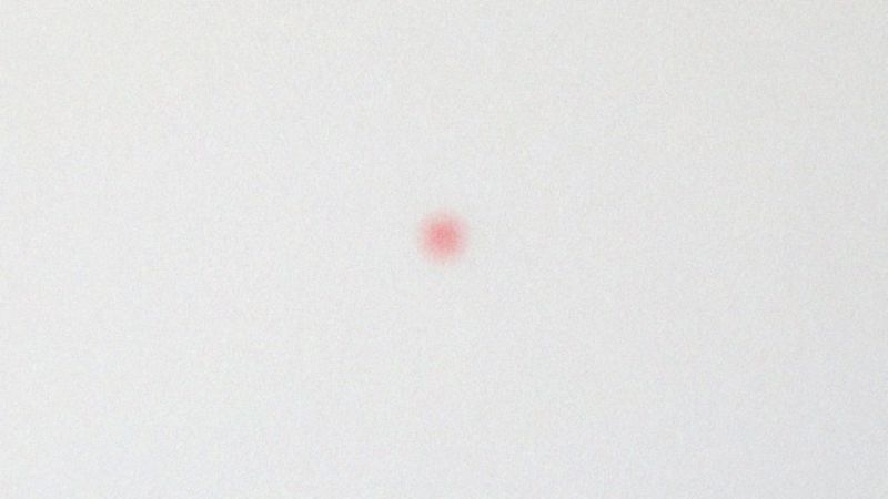 Jakie są objawy różyczki u dzieci i dorosłych?