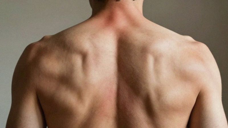 Jakie są objawy napiętych mięśni pleców?