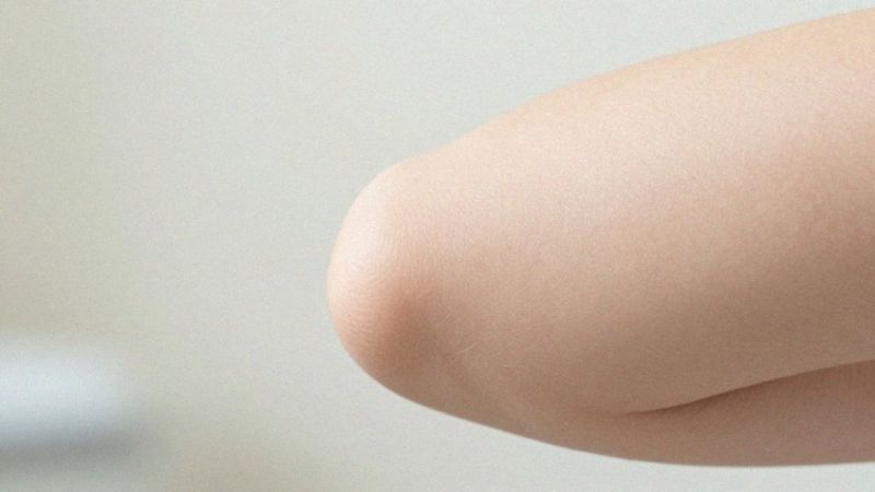 Gdzie na ciele pojawia się lanugo?