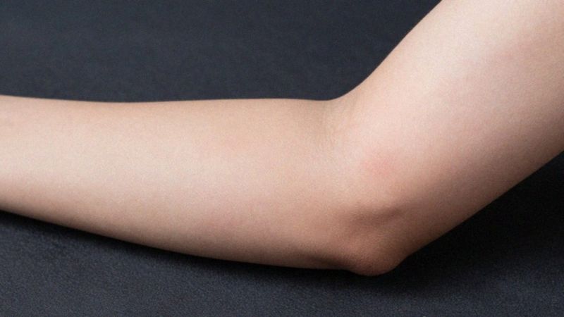 Jakie są objawy nadwyrężenia ścięgna?