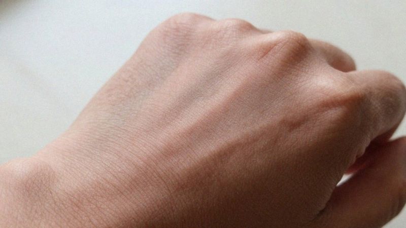 Jak defekt bariery naskórkowej prowadzi do AZS?