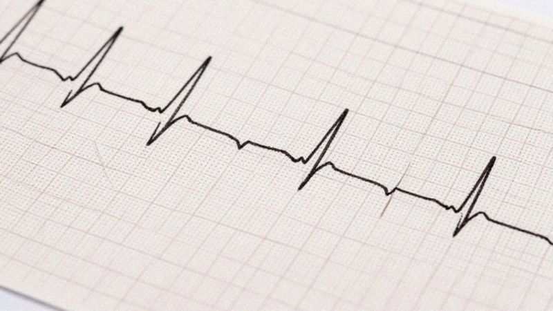 Jak interpretować załamki P i odstępy w EKG?