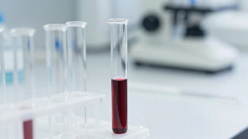 Jakie są hematologiczne skutki stosowania Pyralginy?