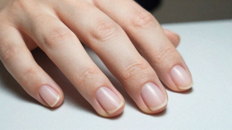 Jakie są przyczyny brodawek okołopaznokciowych?
