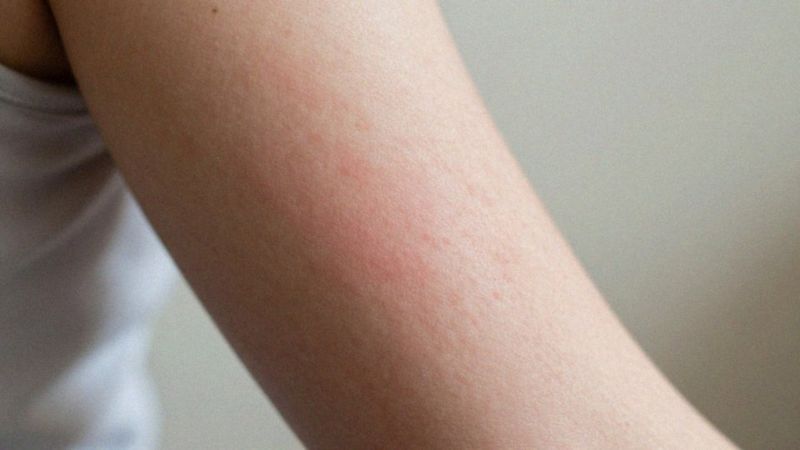 Jakie odczucia bólowe występują w półpaścu?