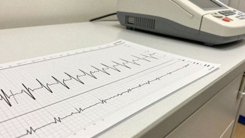 Jak mierzyć częstotliwość i czas trwania skurczów na KTG?