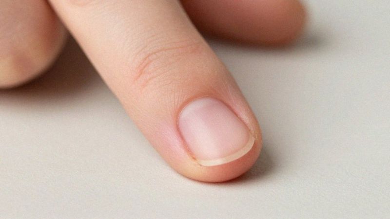 Jakie zmiany na płytce paznokcia mogą niepokoić?