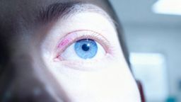Czerwone oko po operacji zeza — co oznacza i kiedy jest niepokojące?