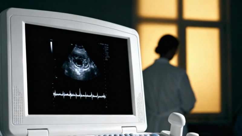 Kiedy bije serce płodu? Etapy rozwoju i monitorowanie tętna