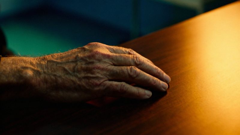 Sklerodermia zdjęcia — jak rozpoznać chorobę i monitorować postępy?